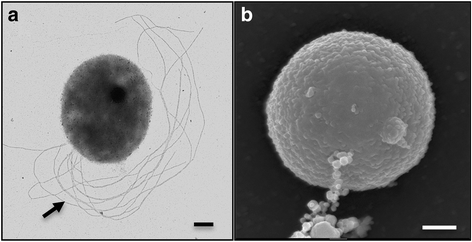 pyrodictium occultum