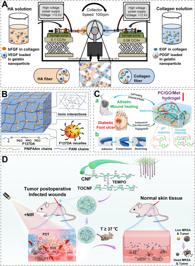 Wound Dressing: From Nanomaterials to Diagnostic Dressings and Healing  Evaluations