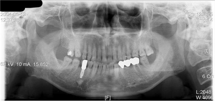 figure 14