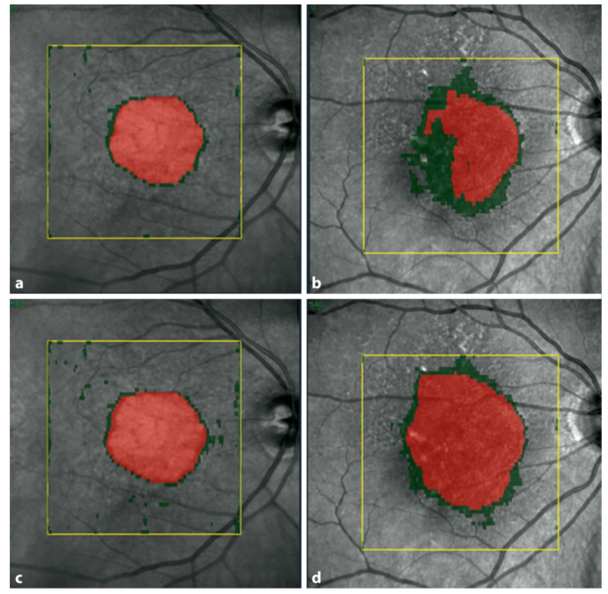 case study of mycin in artificial intelligence figure 4