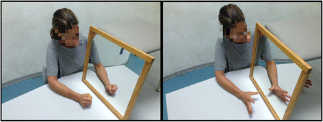 Mirror Therapy For An With Central Post Stroke Pain A Case Report Archives Of Physiotherapy Full Text Post Stroke Pain, How To Use Mirror Therapy For Stroke