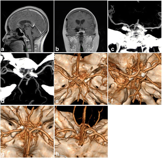 MRI of surgery showed the sagittal (a) and coronal (b) views, and both of t...