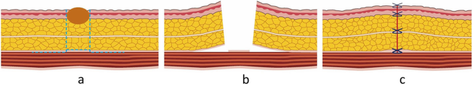 figure 29