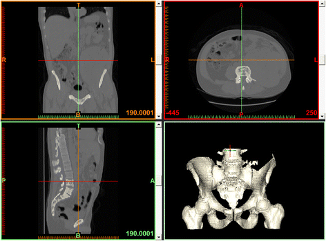 figure 15