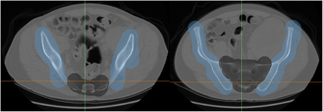 figure 16