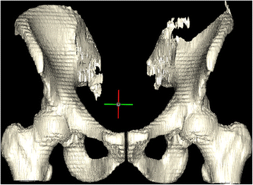 figure 17