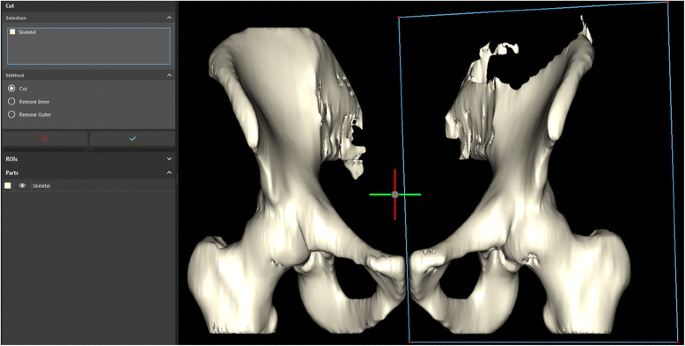 figure 18