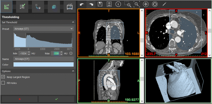 medis medical imaging systems