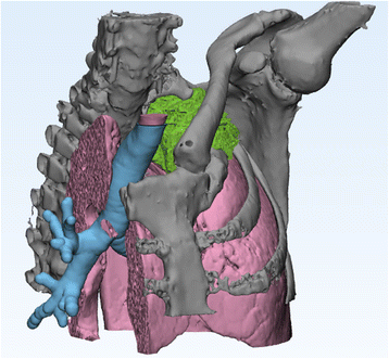 figure 25