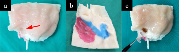 figure 16