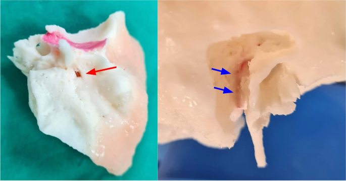 figure 17
