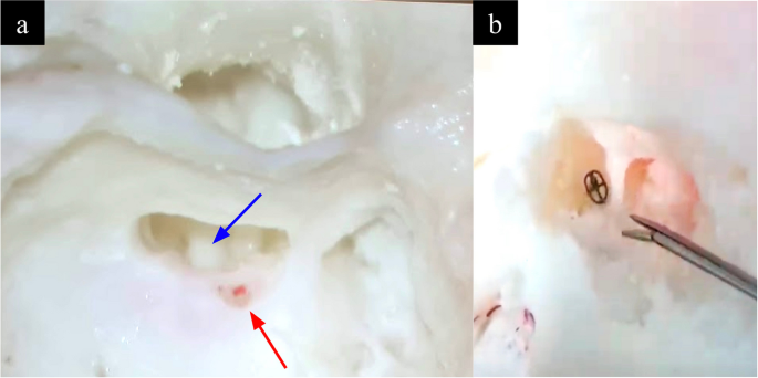 figure 19