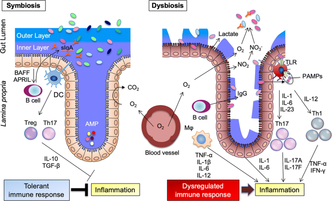 dysbiosis ibd