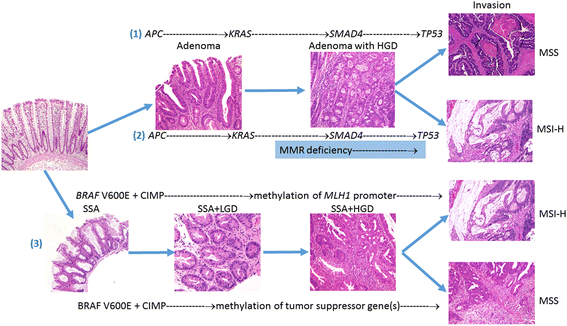 A mikro-RNS-ek patogenetikai és diagnosztikai szerepe mellékvesekéreg-carcinomában