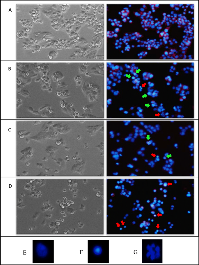 Mrnas Biomarker Related To The Control Of Proliferation And Cell Death In Hepg2 C3a Spheroid And Monolayer Cultures Treated With Piperlongumine Applied Cancer Research Full Text