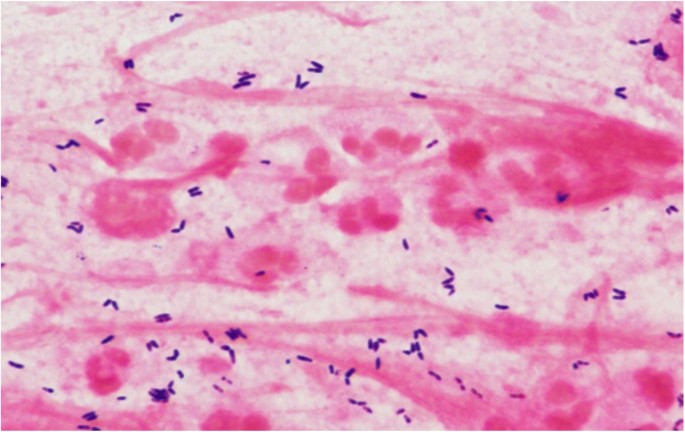 corynebacterium xerosis morphology