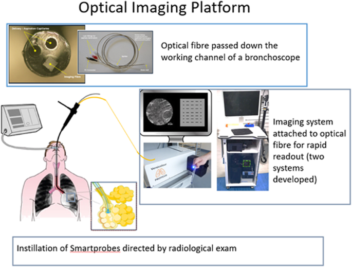 Diagnosing ventilator-associated pneumonia (VAP) in UK NHS ICUs: the  perceived value and role of a novel optical technology | Diagnostic and  Prognostic Research | Full Text