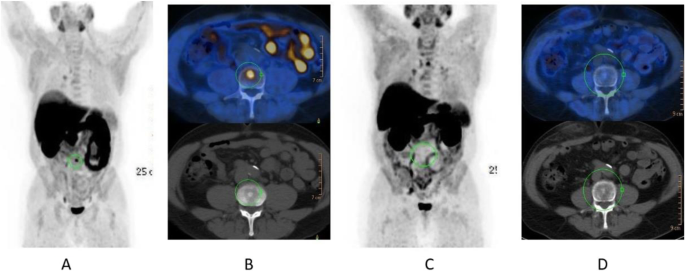 figure 24