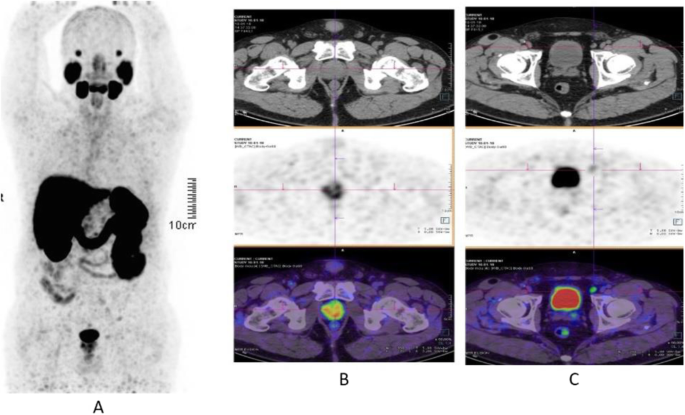 figure 27