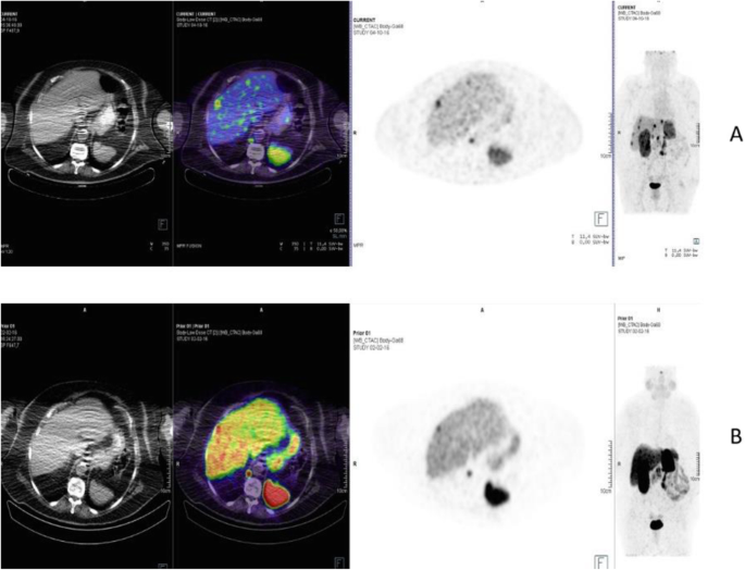 figure 47