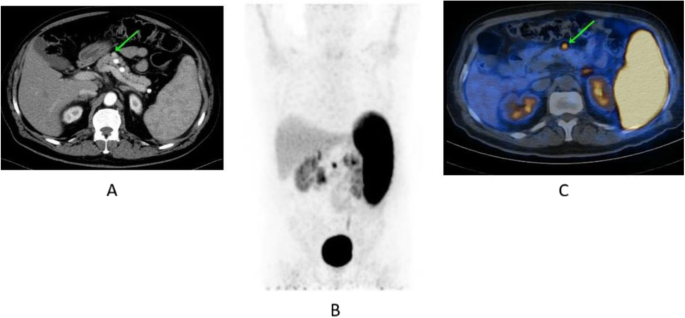 figure 48