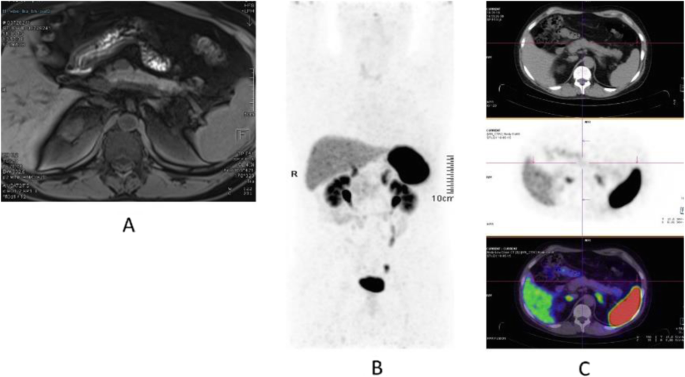 figure 49