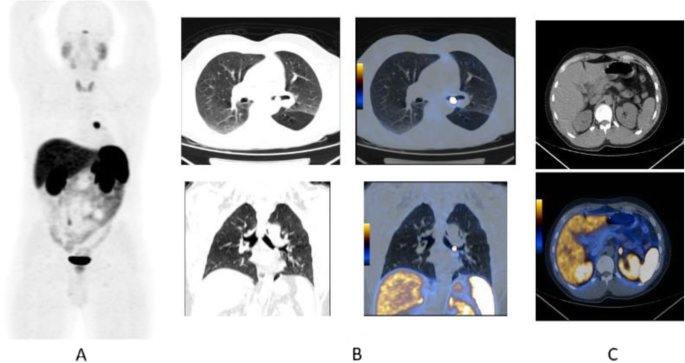 figure 51