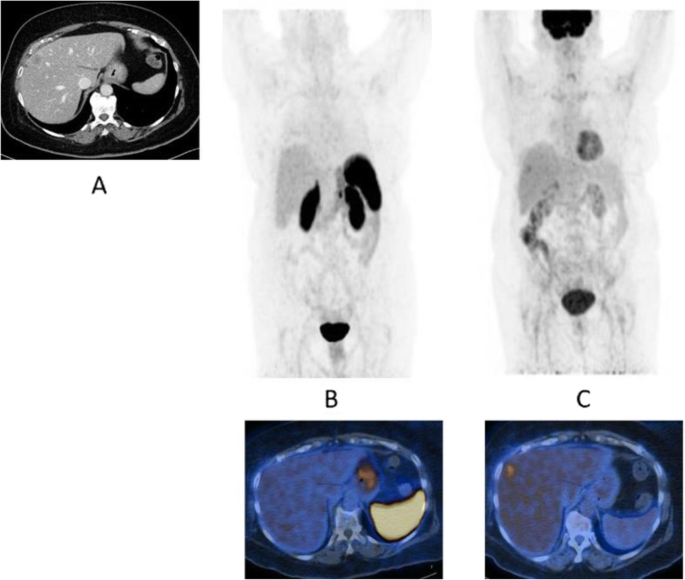 figure 54