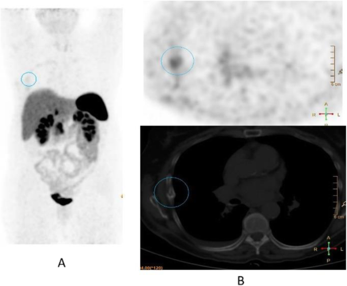 figure 56