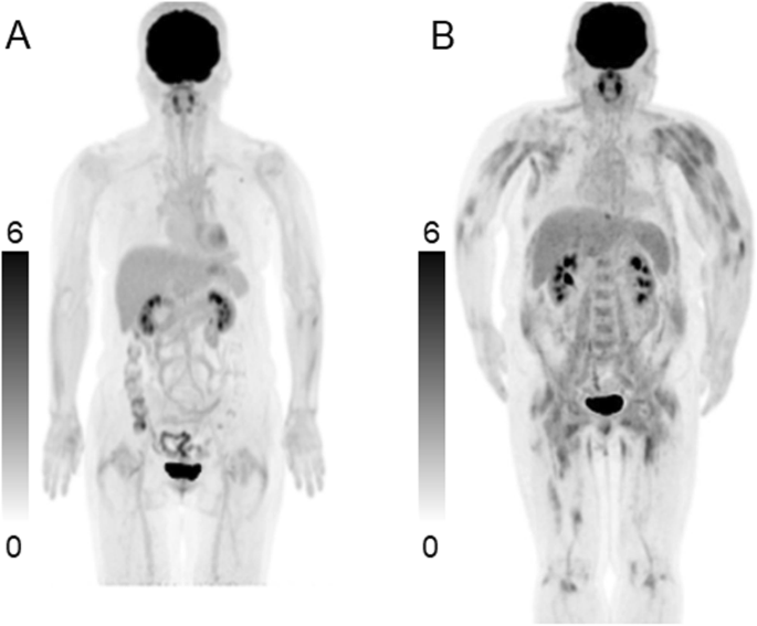 One shaping regarding to walkaway characteristic inside Figs