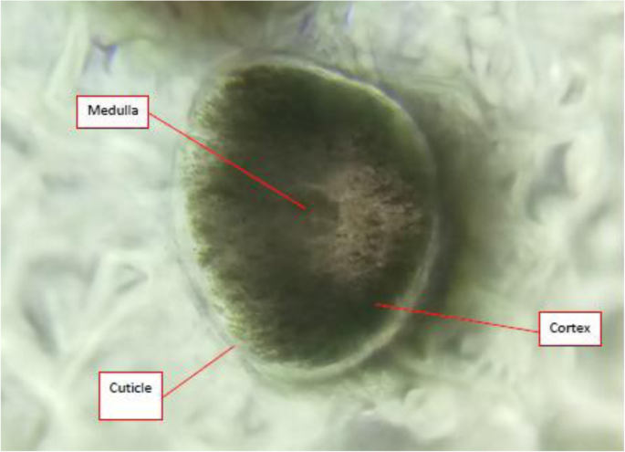 Preliminary Study On Morphometric Analysis Of The Human Scalp Hair For Discrimination Of Ethnic Malay And Ethnic Chinese In Malaysia Egyptian Journal Of Forensic Sciences Full Text