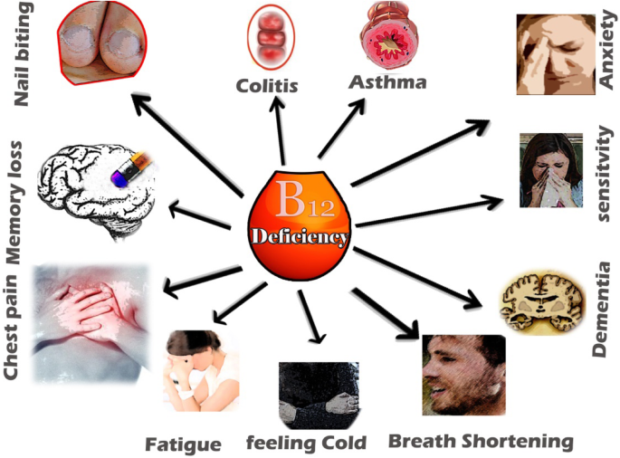 Deficiency of vitamin B12 and its relation with neurological disorders: a  critical review | The Journal of Basic and Applied Zoology | Full Text