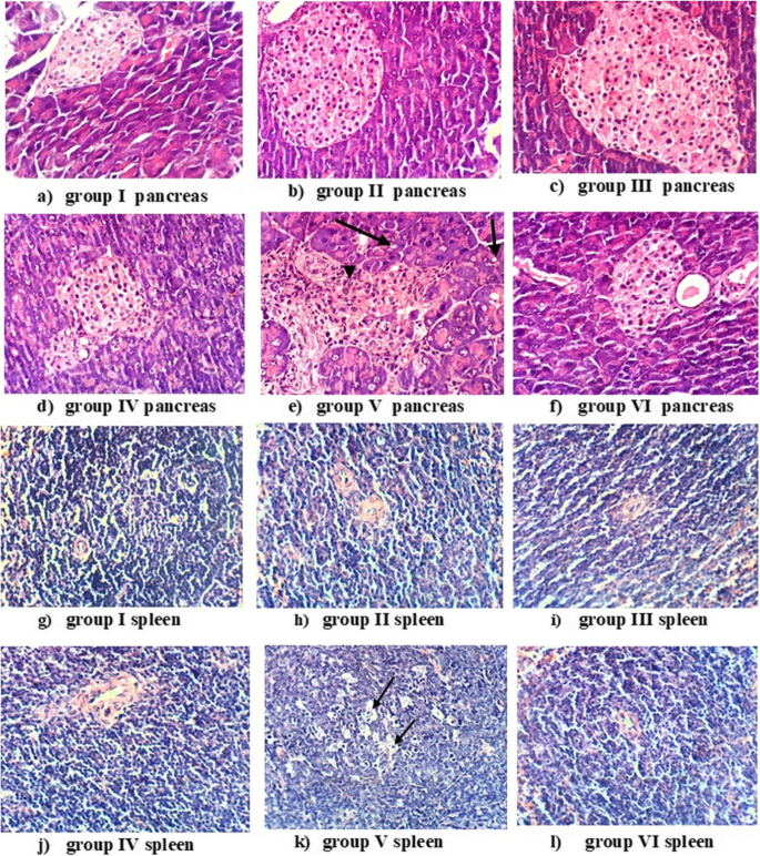 Curcumin Induces Regeneration Of B Cells And Suppression Of Phosphorylated Nf Kb In Streptozotocin Induced Diabetic Mice The Journal Of Basic And Applied Zoology Full Text