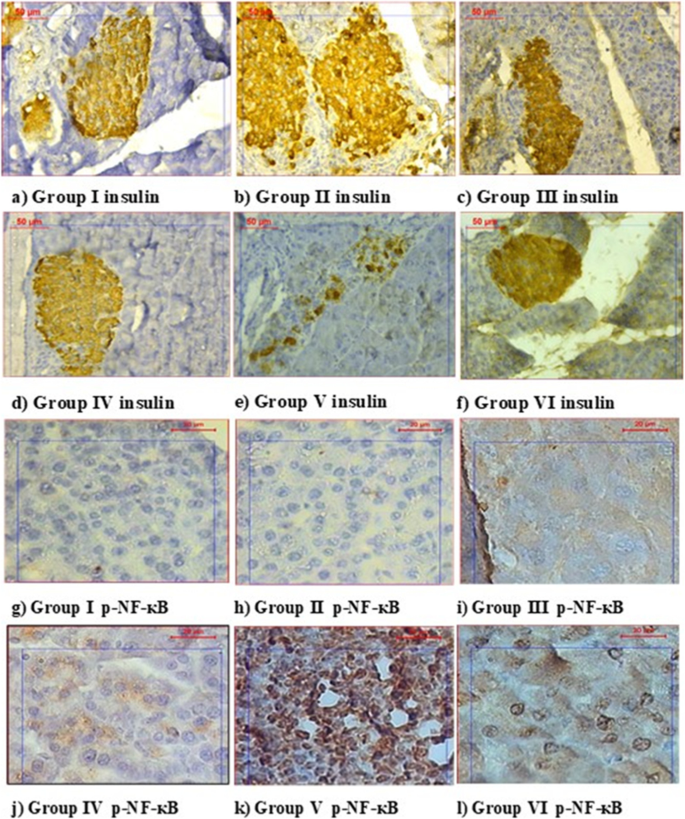 Curcumin Induces Regeneration Of B Cells And Suppression Of Phosphorylated Nf Kb In Streptozotocin Induced Diabetic Mice The Journal Of Basic And Applied Zoology Full Text