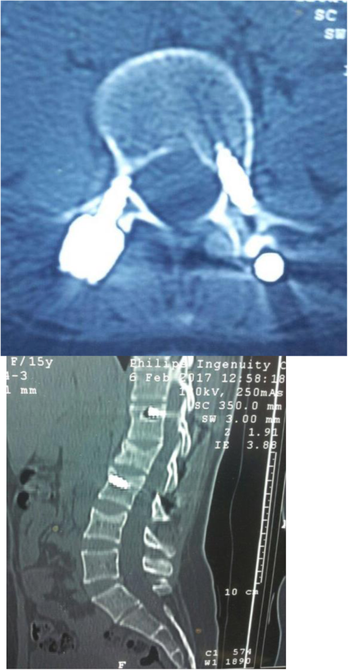 figure 19