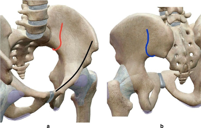 figure 17