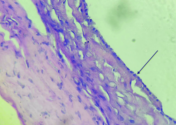 Bubbles in the belly- a case based approach to cystic ...