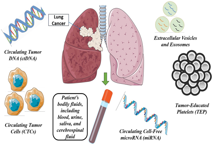 The fundamental role of liquid biopsy in lung cancer: a shift in ...