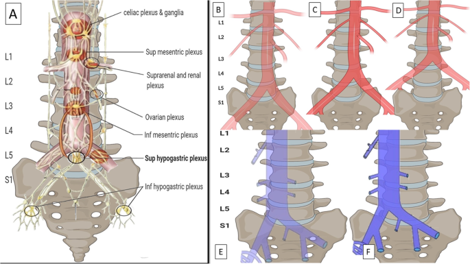 Superior hypogastric nerve block (SHNB) for pain control after uterine  fibroid embolization (UFE): technique and troubleshooting | CVIR  Endovascular | Full Text