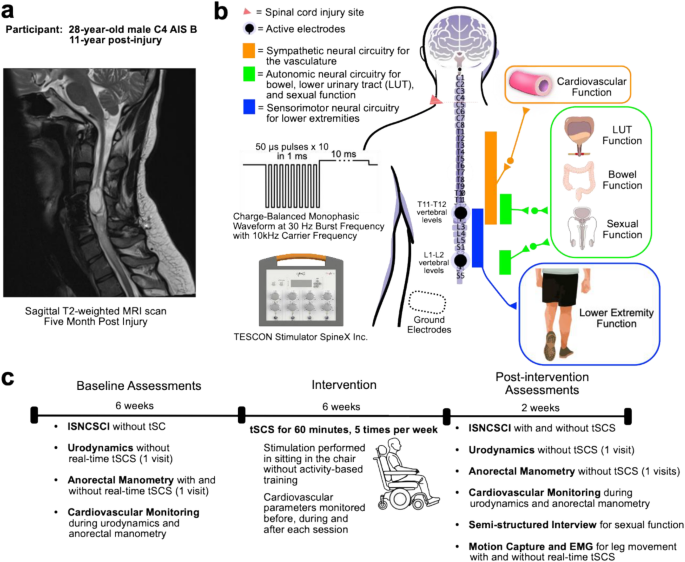 Multi-system benefits of non-invasive spinal cord stimulation following ...