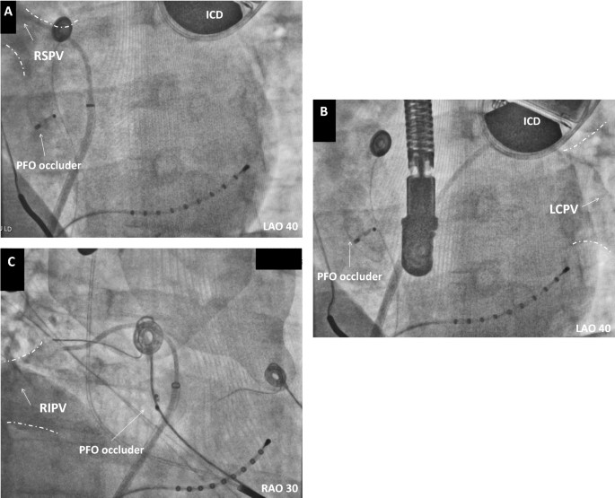 figure 15