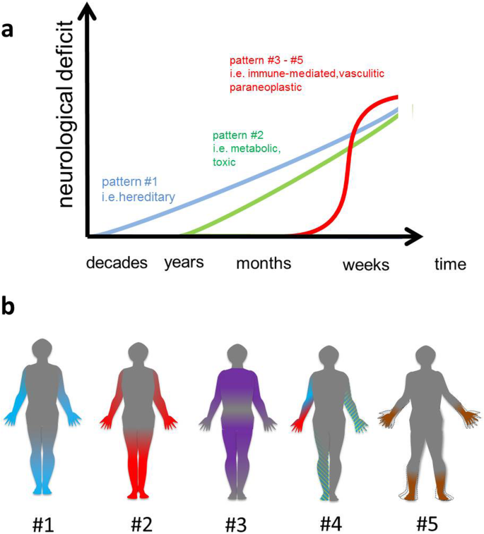 Diagnosis of peripheral neuropathy | Neurological Research and Practice |  Full Text