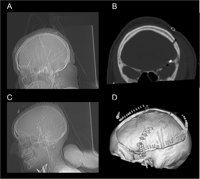 eeg medical abbreviation eeg medical abbreviation