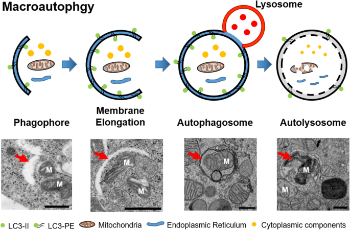 The Autophagy Research In Electron Microscopy Applied Microscopy Full Text The Autophagy Research In Electron Microscopy Applied Microscopy Full Text