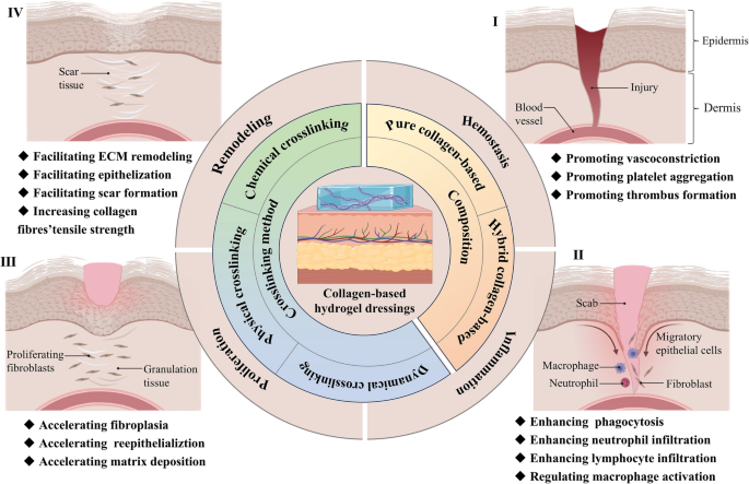 Recent progress of collagen-based hydrogels for wound healing: a review ...
