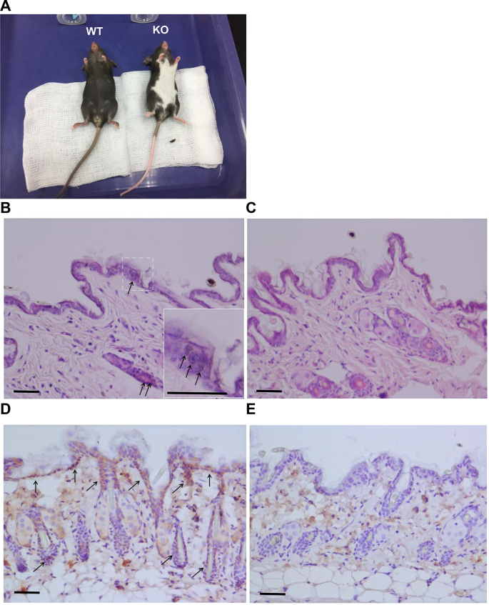 Characterization of Ets-1 deficiency-induced depigmentation in a mouse ...