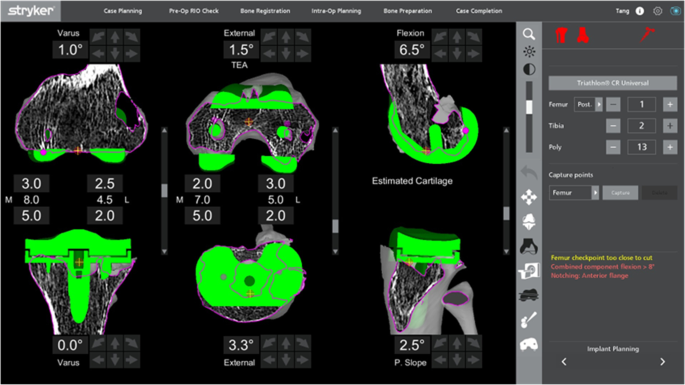 figure 15