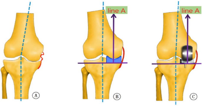 figure 26