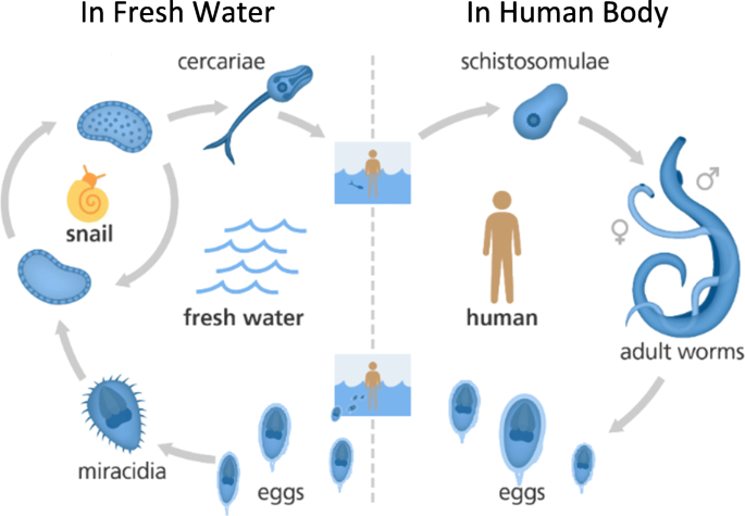 Schistosomiasis urinary. Schistosomiasis urine