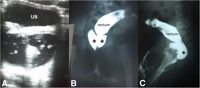 figure 16